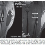 en_a14fig02