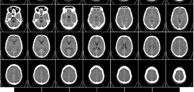 JC: Time is brain…., calling #FOAMagitators. St.Emlyn’s