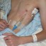 JC: Should we use Heimlich Valves for ambulatory pneumothorax management? St. Emlyn’s